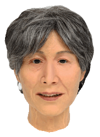 After fitting the ocular prosthesis