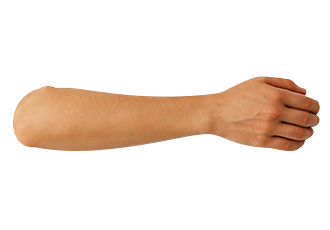 Below Elbow Prosthesis Cosmetic Type